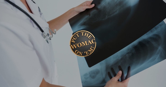 doctor looking at back x rays